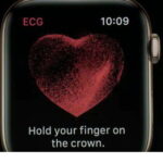 Apple Watch con EKG: lo que puede y no puede hacer- 6